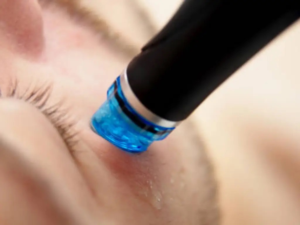 Why Hydrabrasion is Toronto's #1 Glow-Up Treatment in 2025