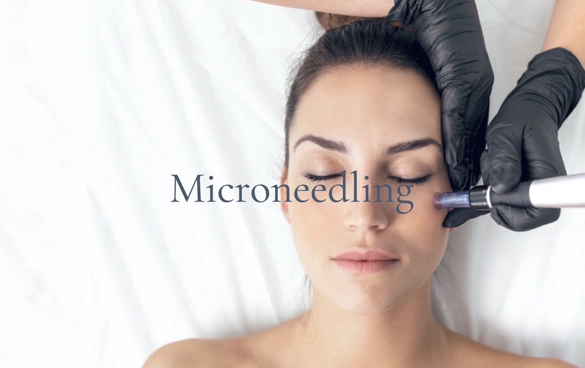 Microneedling Benefits: Real Results & What to Expect