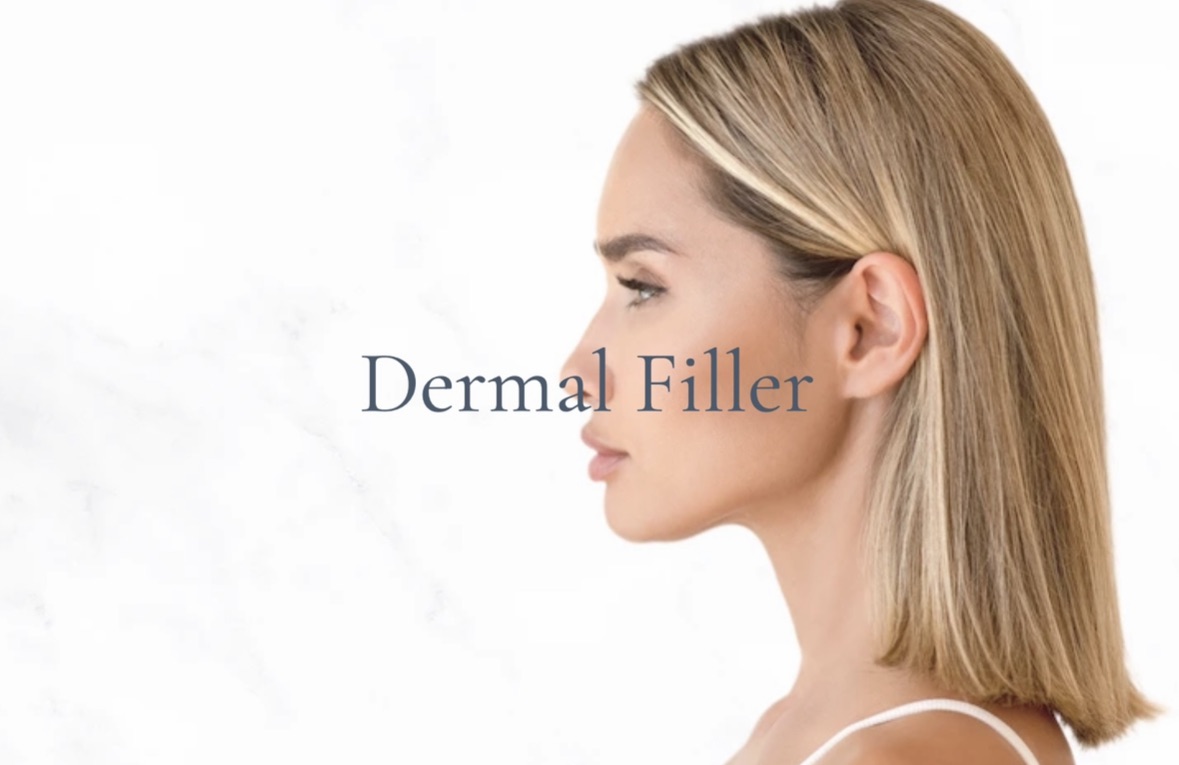 Dermal Fillers Explained: Juvederm vs Restylane vs Teosyal